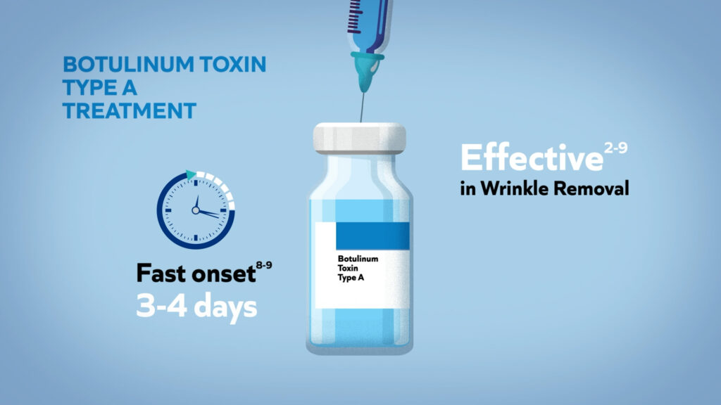 Botulinum toxin Type A treatment for wrinkle removal with fast onset